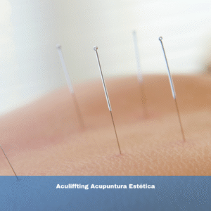 Aculiffting Acupuntura Estética