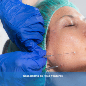 Especialista en Hilos Tensores